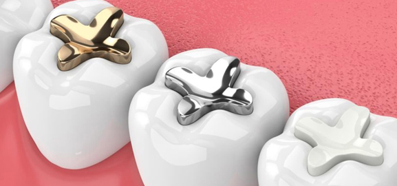 Three white decorative tooth-shaped containers with gold and silver airplane toppers on pink background.
