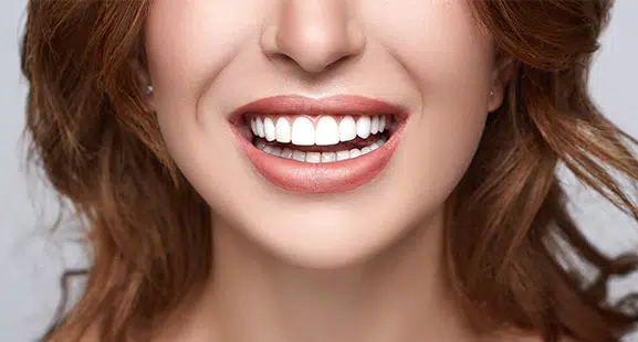 Woman smiling brightly, showing healthy white teeth and red lipstick against neutral background.