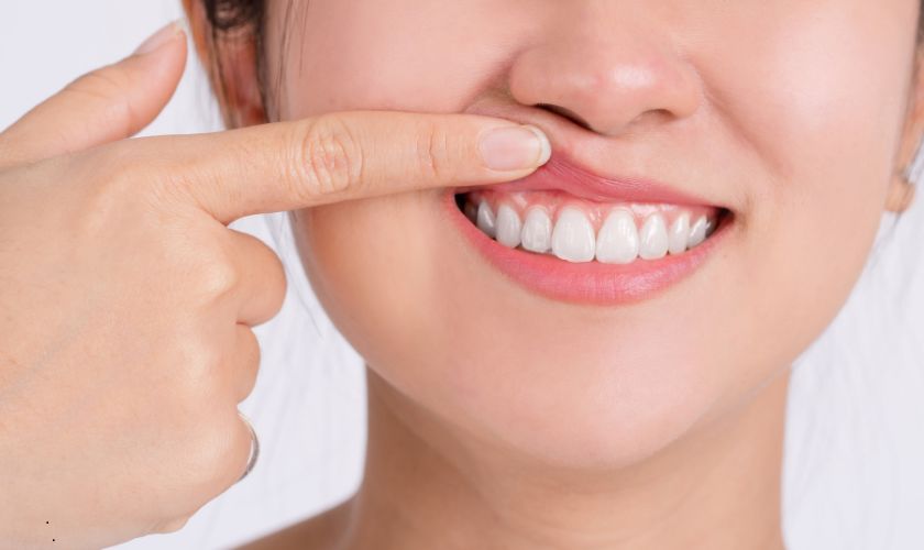 Conditions Treated by a Periodontist